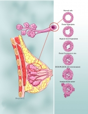 DCIS.layered-copy