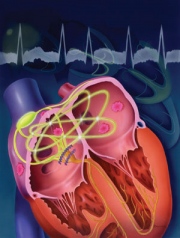 GP-21.Atrial.fibrillation