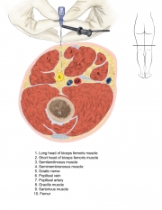 N-3.Popliteal-xsxn-copy